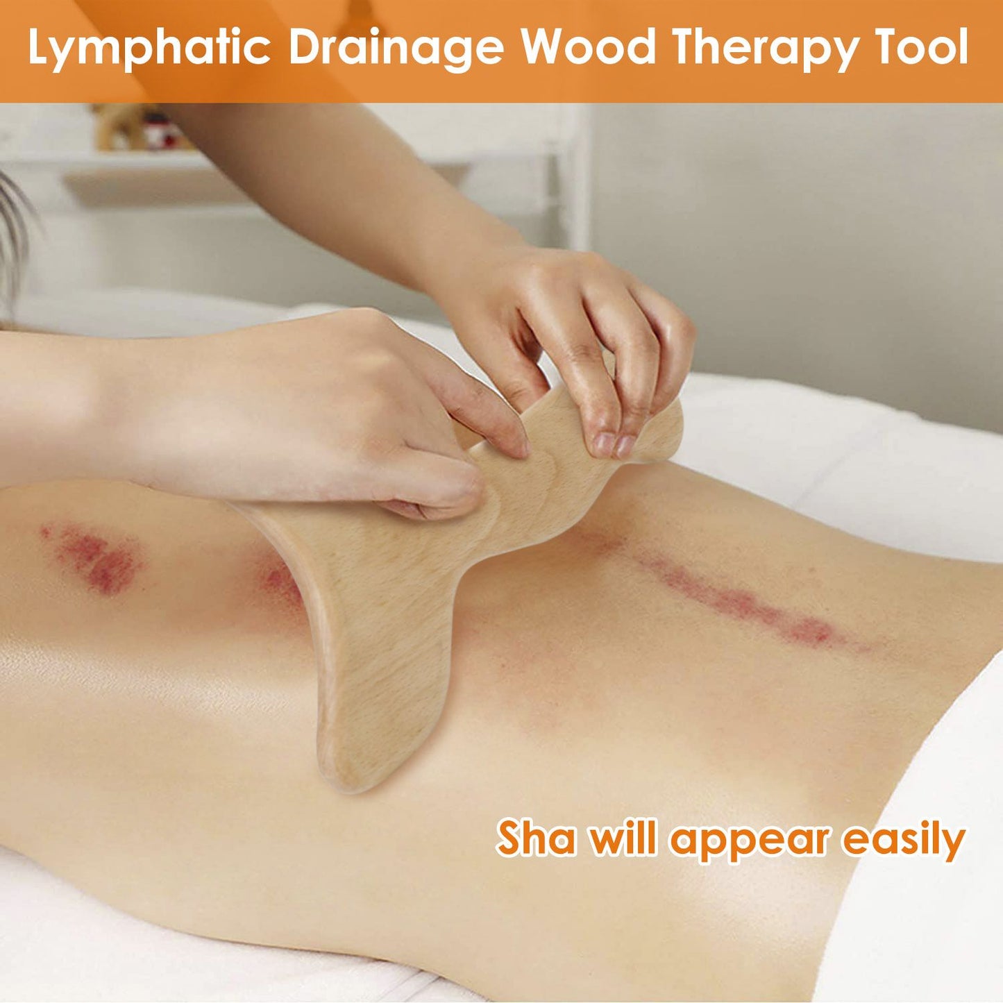 A person performing lymphatic drainage therapy using a wooden massaging tool on a client's back, highlighting the therapeutic effects and skin bruising.