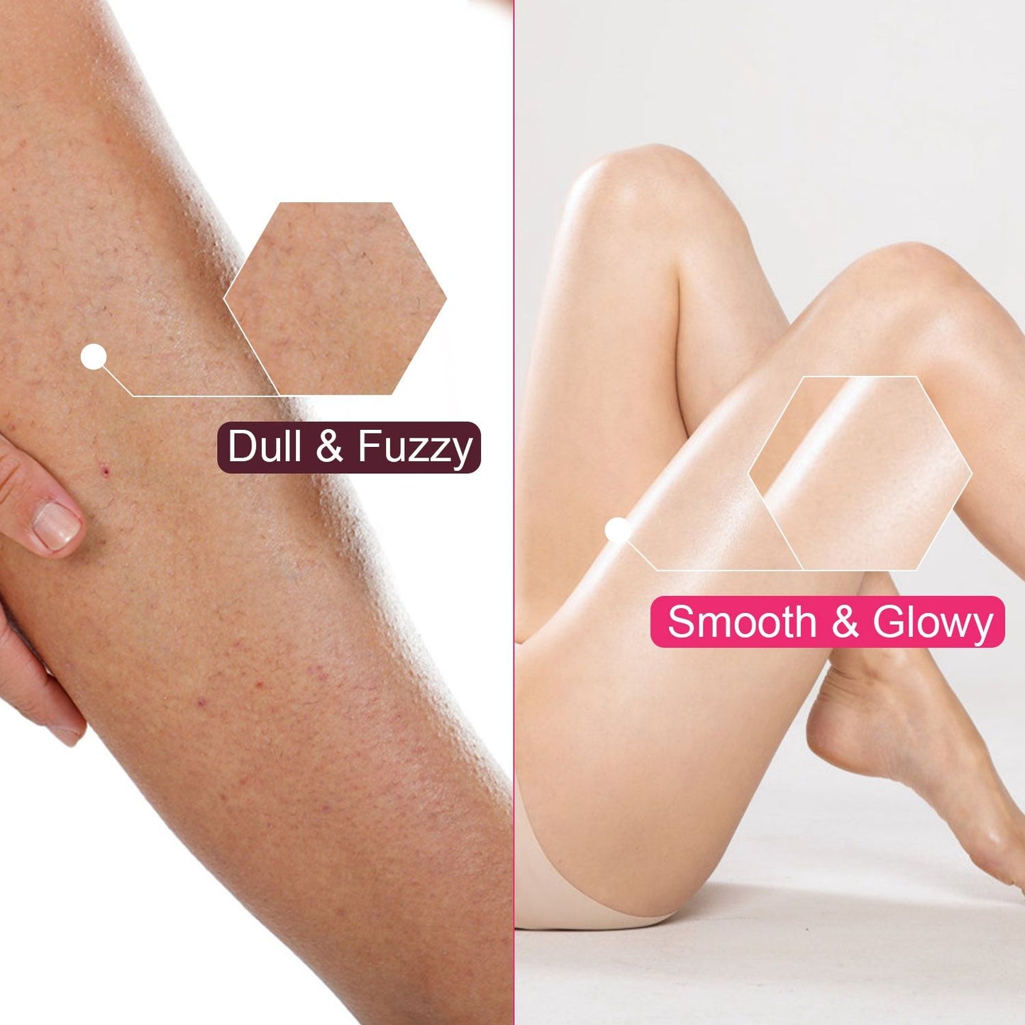 Before and after comparison of leg skin: left side shows dull and fuzzy texture, while the right side displays smooth and glowy skin appearance, highlighting the transformation.