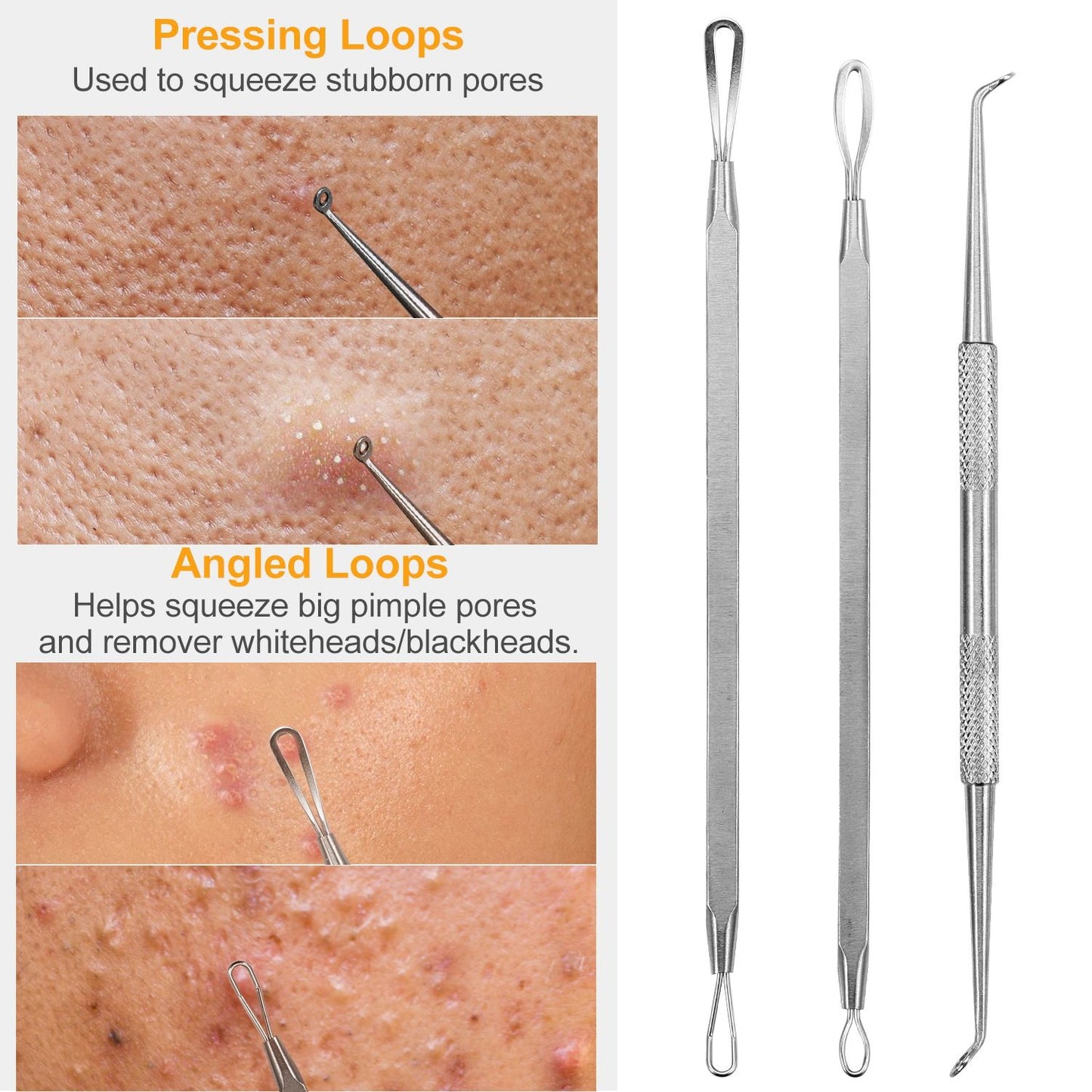 Stainless steel pimple extractor tools demonstrating pressing and angled loops for effectively removing blackheads and whiteheads from skin pores.