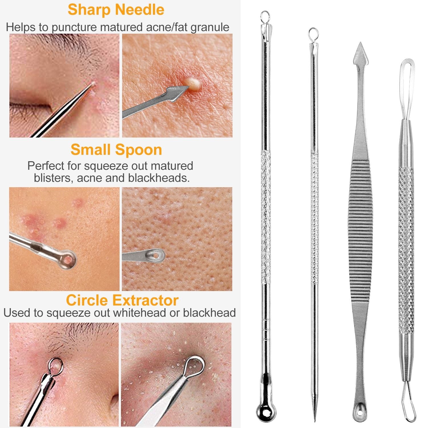 Stainless steel skin care extraction tools set featuring a sharp needle, small spoon for blemishes, and circle extractor for blackheads, with close-up images demonstrating their use on skin.