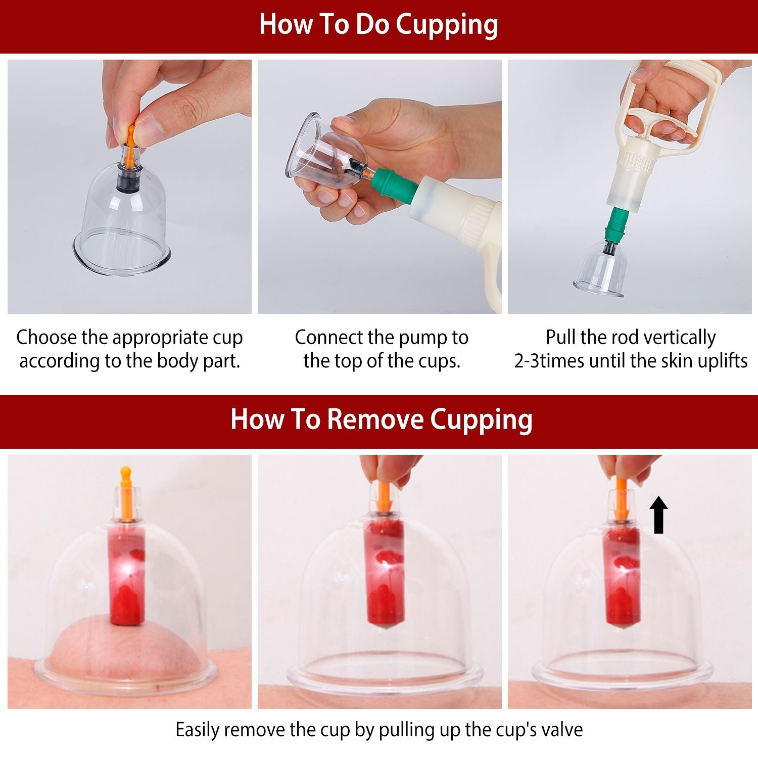 Instructional guide on how to perform and remove cupping therapy, featuring images of the cupping process, including cup selection, pump connection, and skin suction techniques.