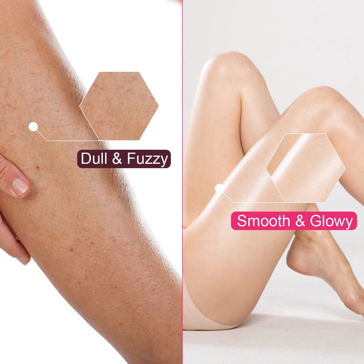 Before and after comparison of leg skin: left side shows dull and fuzzy texture, while the right side displays smooth and glowy skin appearance, highlighting the transformation.
